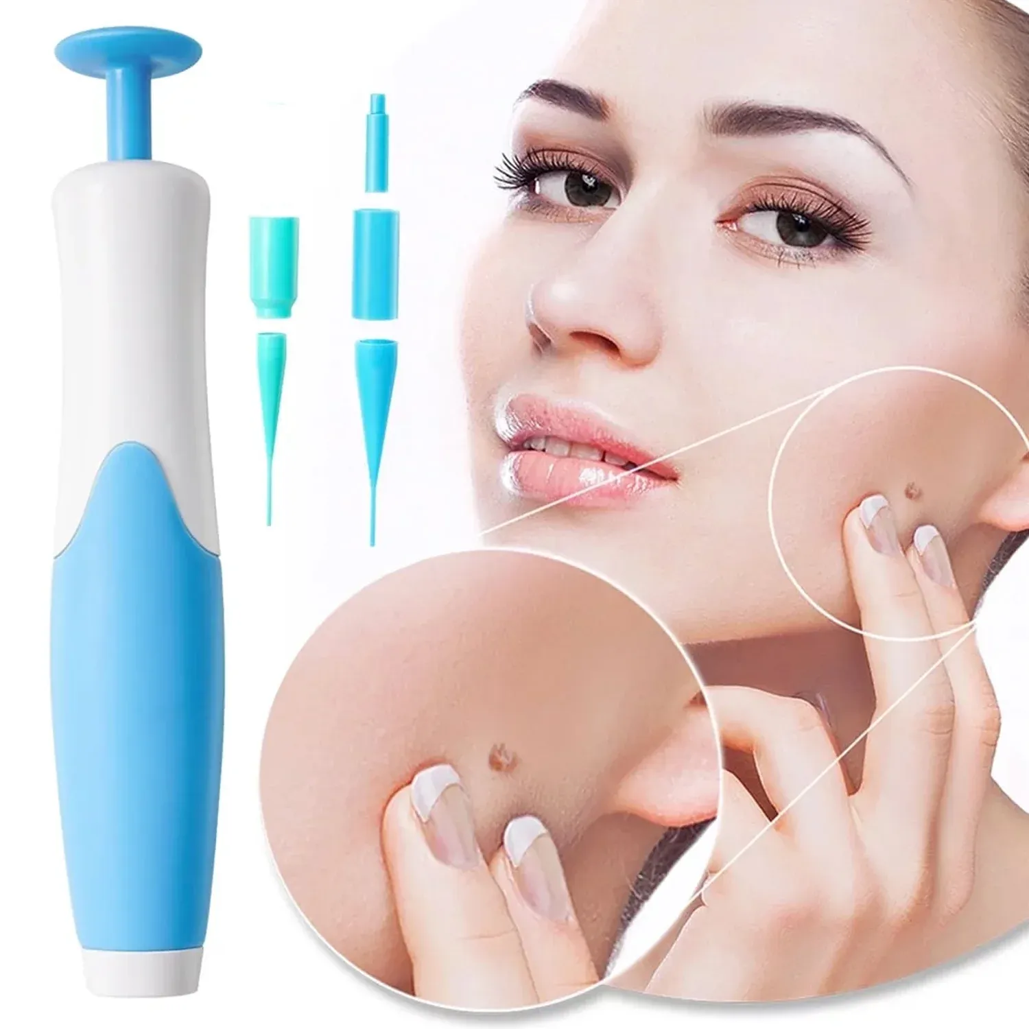 Skin Tag Remover Kit 2-in-1 – Painless Home Use | Arrive Kit - Detailed Feature View 2