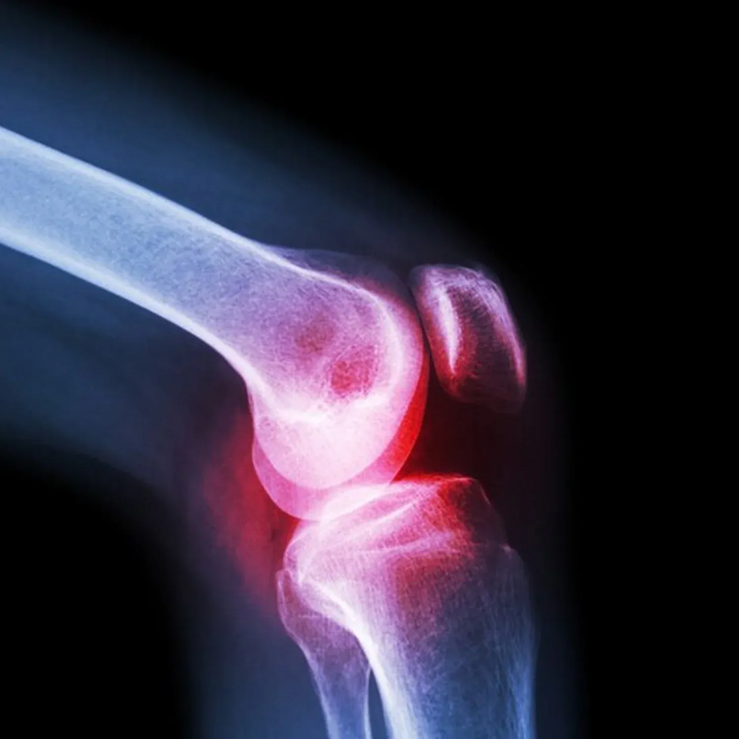 Knee Cap for Support – Large Size for Joint Relief | Velvet Wellness - Detailed Feature View 5